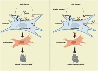 Combination of ADAM17 knockdown with eplerenone is more effective than single therapy in ameliorating diabetic cardiomyopathy